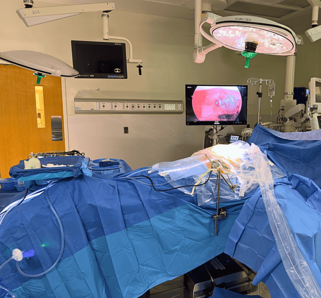 PIPAC in Use in OR